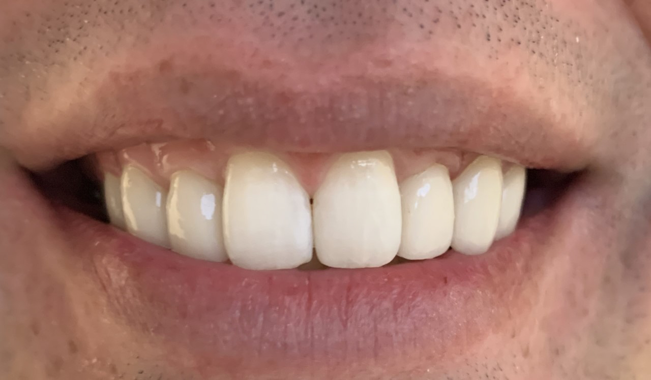 Gentle Dentistry of Newnan PC Gentle Dentistry of Newnan PC