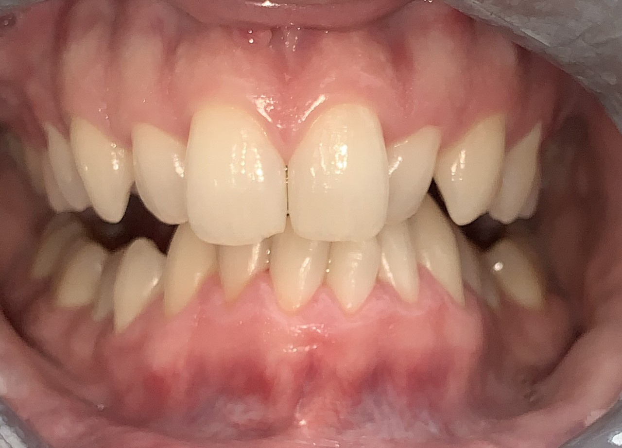 Gentle Dentistry of Newnan PC Gentle Dentistry of Newnan PC