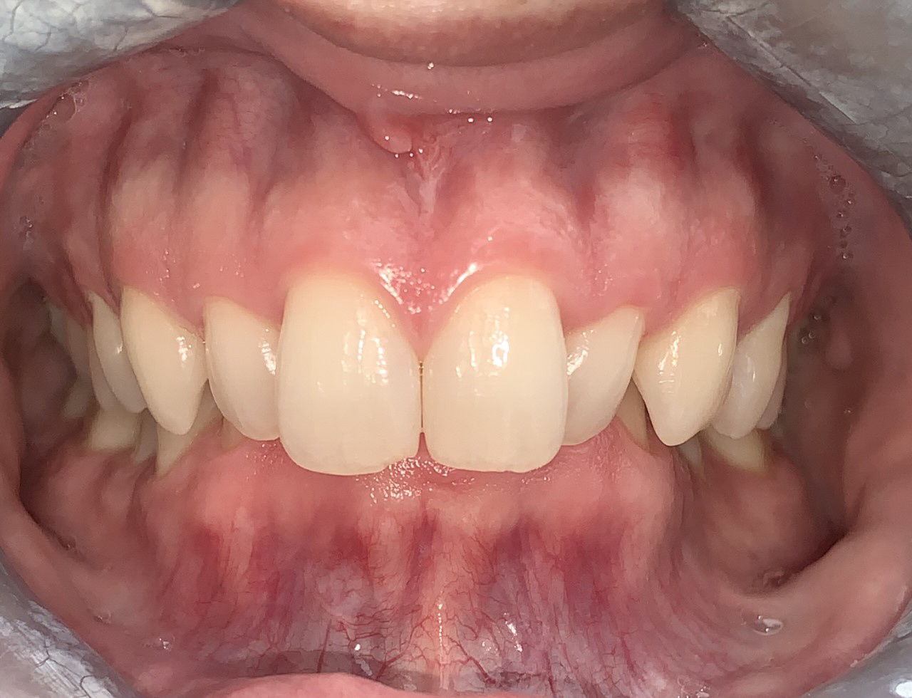 Gentle Dentistry of Newnan PC Gentle Dentistry of Newnan PC