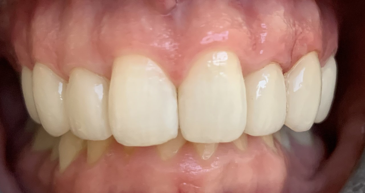 Gentle Dentistry of Newnan PC Gentle Dentistry of Newnan PC