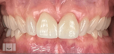 Gentle Dentistry of Newnan PC Gentle Dentistry of Newnan PC