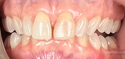 Gentle Dentistry of Newnan PC Gentle Dentistry of Newnan PC