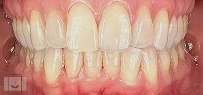 Gentle Dentistry of Newnan PC Gentle Dentistry of Newnan PC