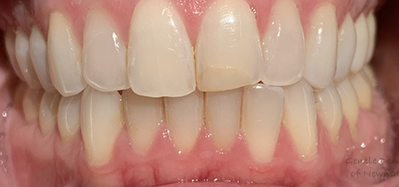 Gentle Dentistry of Newnan PC Gentle Dentistry of Newnan PC