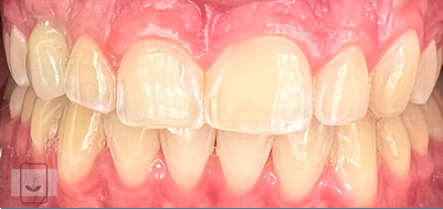 Gentle Dentistry of Newnan PC Gentle Dentistry of Newnan PC