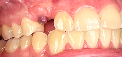 Gentle Dentistry of Newnan PC Gentle Dentistry of Newnan PC