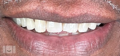 Gentle Dentistry of Newnan PC Gentle Dentistry of Newnan PC