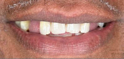 Gentle Dentistry of Newnan PC Gentle Dentistry of Newnan PC