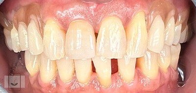 Gentle Dentistry of Newnan PC Gentle Dentistry of Newnan PC