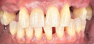 Gentle Dentistry of Newnan PC Gentle Dentistry of Newnan PC