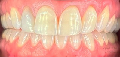 Gentle Dentistry of Newnan PC Gentle Dentistry of Newnan PC