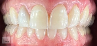 Gentle Dentistry of Newnan PC Gentle Dentistry of Newnan PC