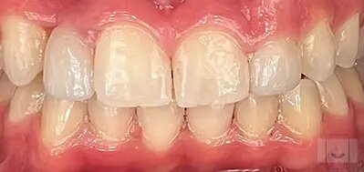 Gentle Dentistry of Newnan PC Gentle Dentistry of Newnan PC