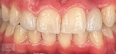 Gentle Dentistry of Newnan PC Gentle Dentistry of Newnan PC