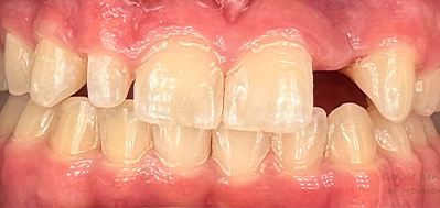 Gentle Dentistry of Newnan PC Gentle Dentistry of Newnan PC