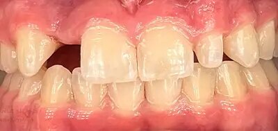 Gentle Dentistry of Newnan PC Gentle Dentistry of Newnan PC