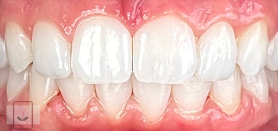 Gentle Dentistry of Newnan PC Gentle Dentistry of Newnan PC