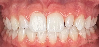 Gentle Dentistry of Newnan PC Gentle Dentistry of Newnan PC