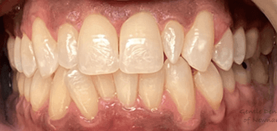 Gentle Dentistry of Newnan PC Gentle Dentistry of Newnan PC