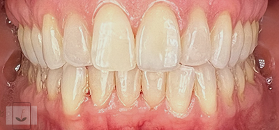 Gentle Dentistry of Newnan PC Gentle Dentistry of Newnan PC