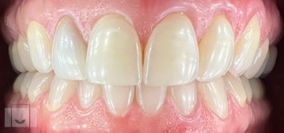 Gentle Dentistry of Newnan PC Gentle Dentistry of Newnan PC