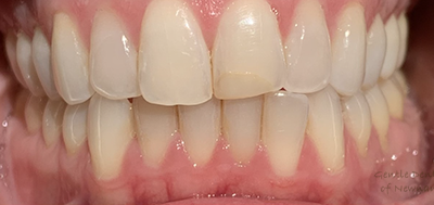 Gentle Dentistry of Newnan PC Gentle Dentistry of Newnan PC